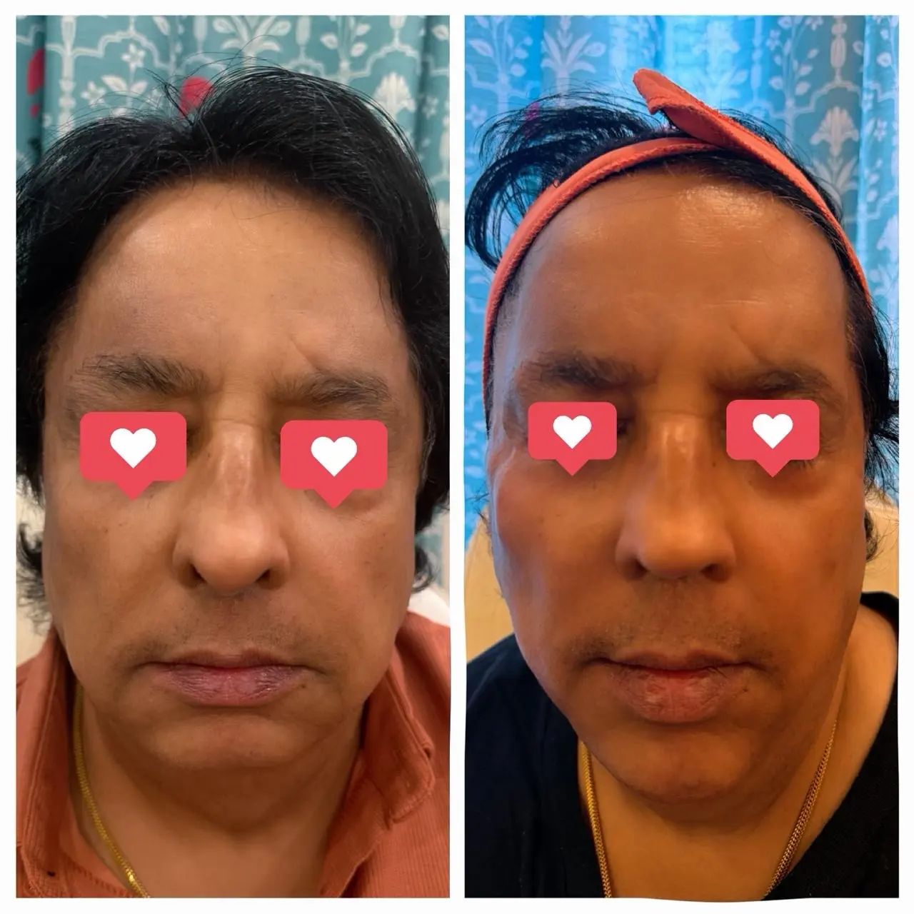Client result